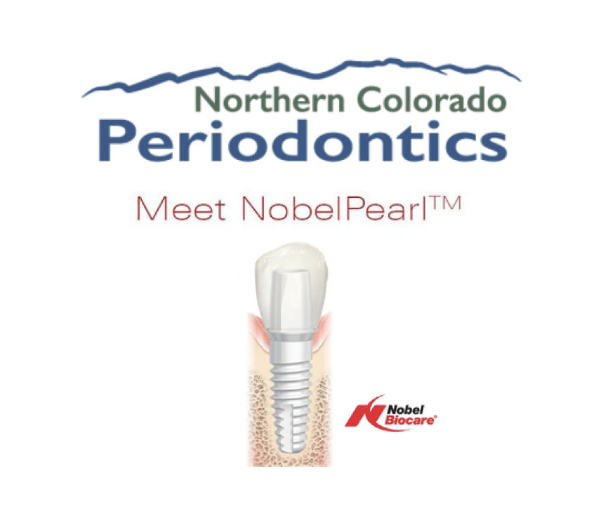  Zirconia Dental Implants Nobel Pearl